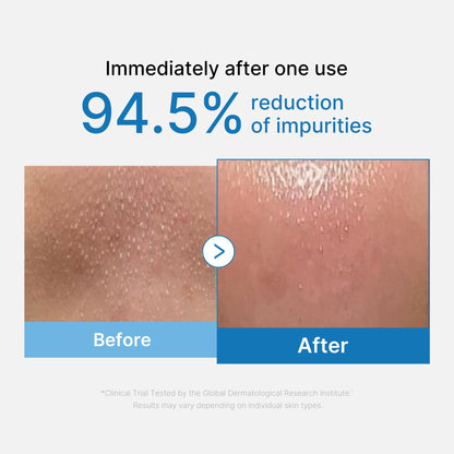 Zero Pore Blackhead Deep Cleansing Oil