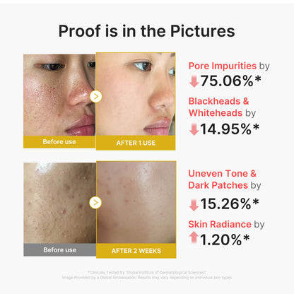 Kojic Acid Turmeric Peel Shot