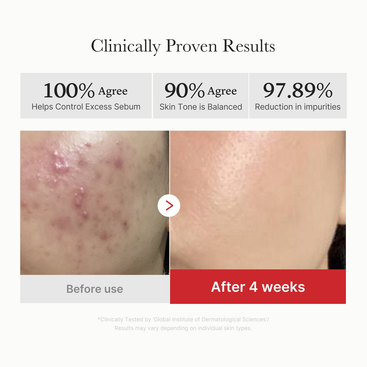 [Subscr.] Red Succinic Acid Panthenol Pads