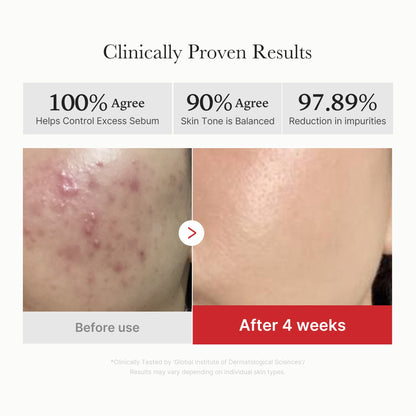 [Subscr.] Red Succinic Acid Panthenol Pads