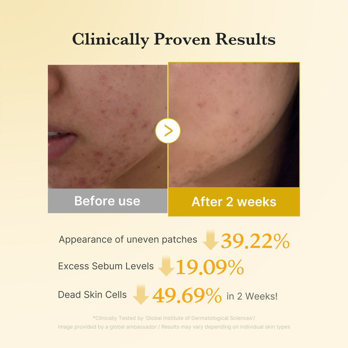 [GIFT] Kojic Acid Turmeric Toner Pad