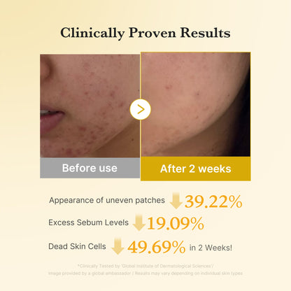 [Subscr.] Kojic Acid Turmeric Toner Pad