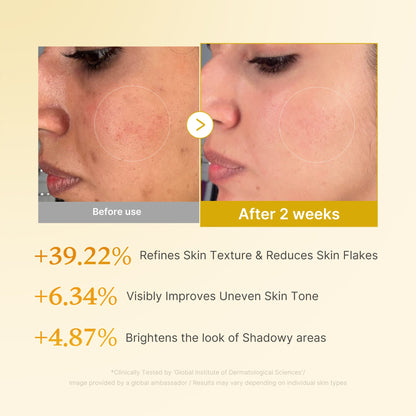 [Subscr.] Kojic Acid Turmeric Toner