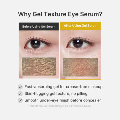 Kojic Acid Turmeric Eye Gel Serum