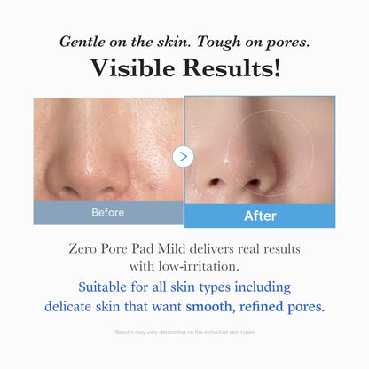 [Subscr.] Zero Pore Madecassoside Pads (Mild)