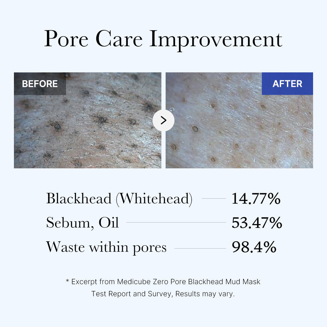 [GIFT] Zero Pore Blackhead Mud Mask