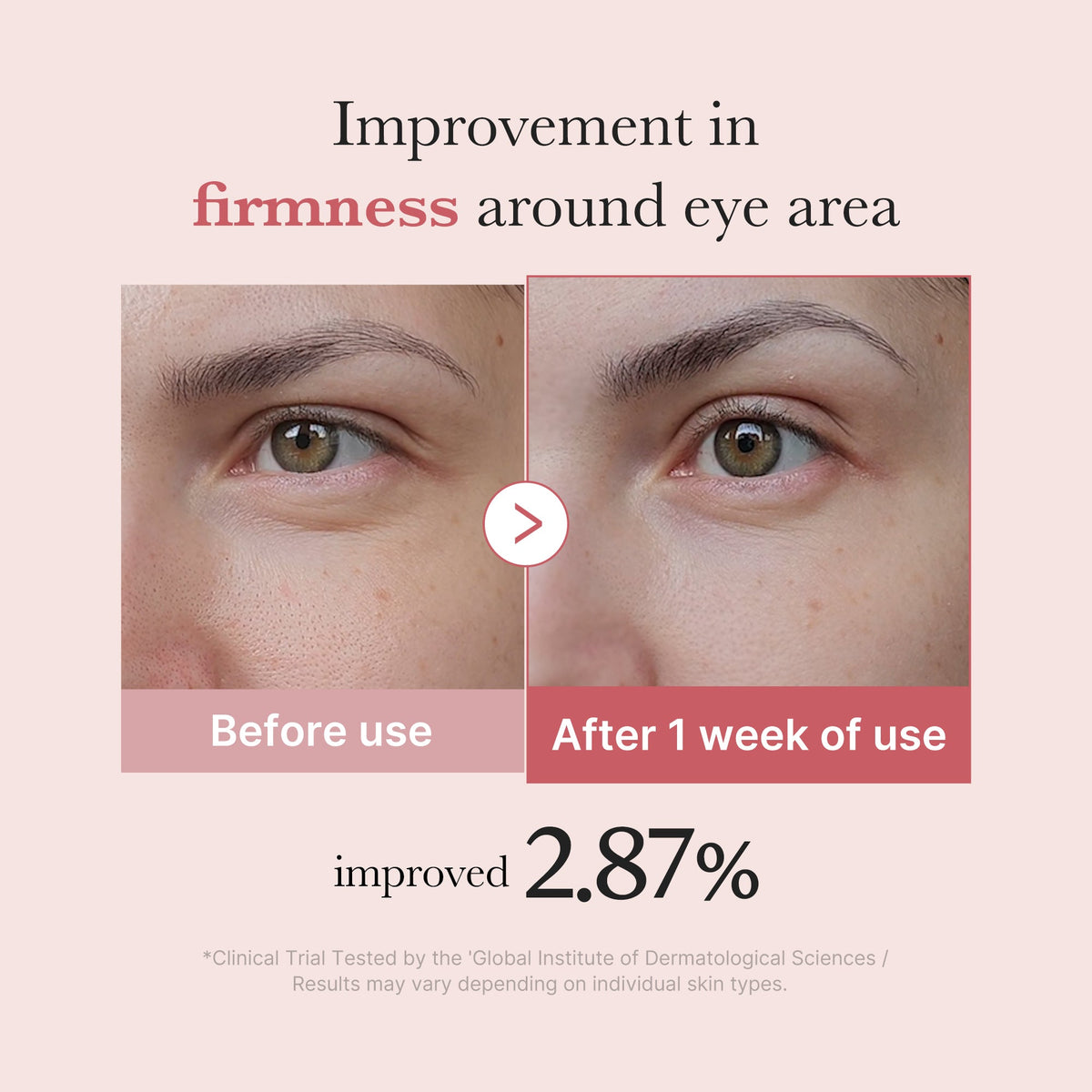 [GIFT] PDRN Pink Peptide Eye Cream